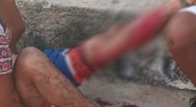 Surfista sofre ataque de tubarão na praia dos Milagres (PE).